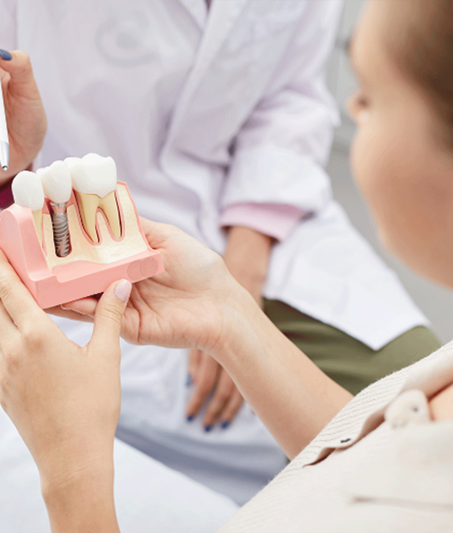A imagem exibe um profissional de odontologia, presumivelmente um dentista ou assistente dental, segurando um modelo de demonstração de um dente com implante dentário. Este modelo mostra como um implante dentário se parece e como é colocado no osso da mandíbula. O paciente, cujo rosto não está visível, parece estar olhando atentamente para o modelo. Este tipo de modelo é frequentemente utilizado para educar os pacientes sobre procedimentos dentários específicos e ajudá-los a compreender o que será feito em seus próprios tratamentos. A interação parece ser informativa, com o profissional explicando o processo ou a estrutura dos dentes e implantes para o paciente.